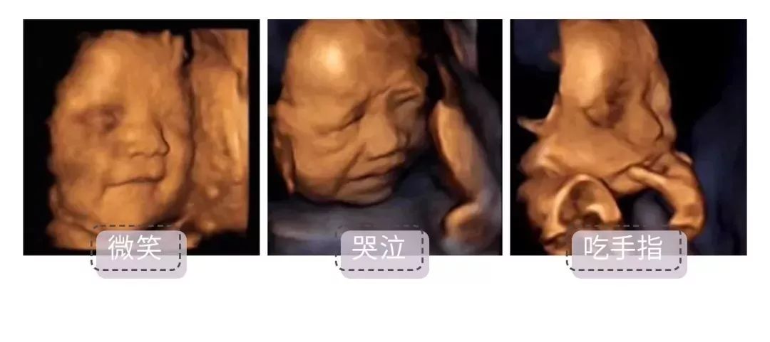 孕期要做的超声影像（四维彩超）检查，这些你都知道吗？